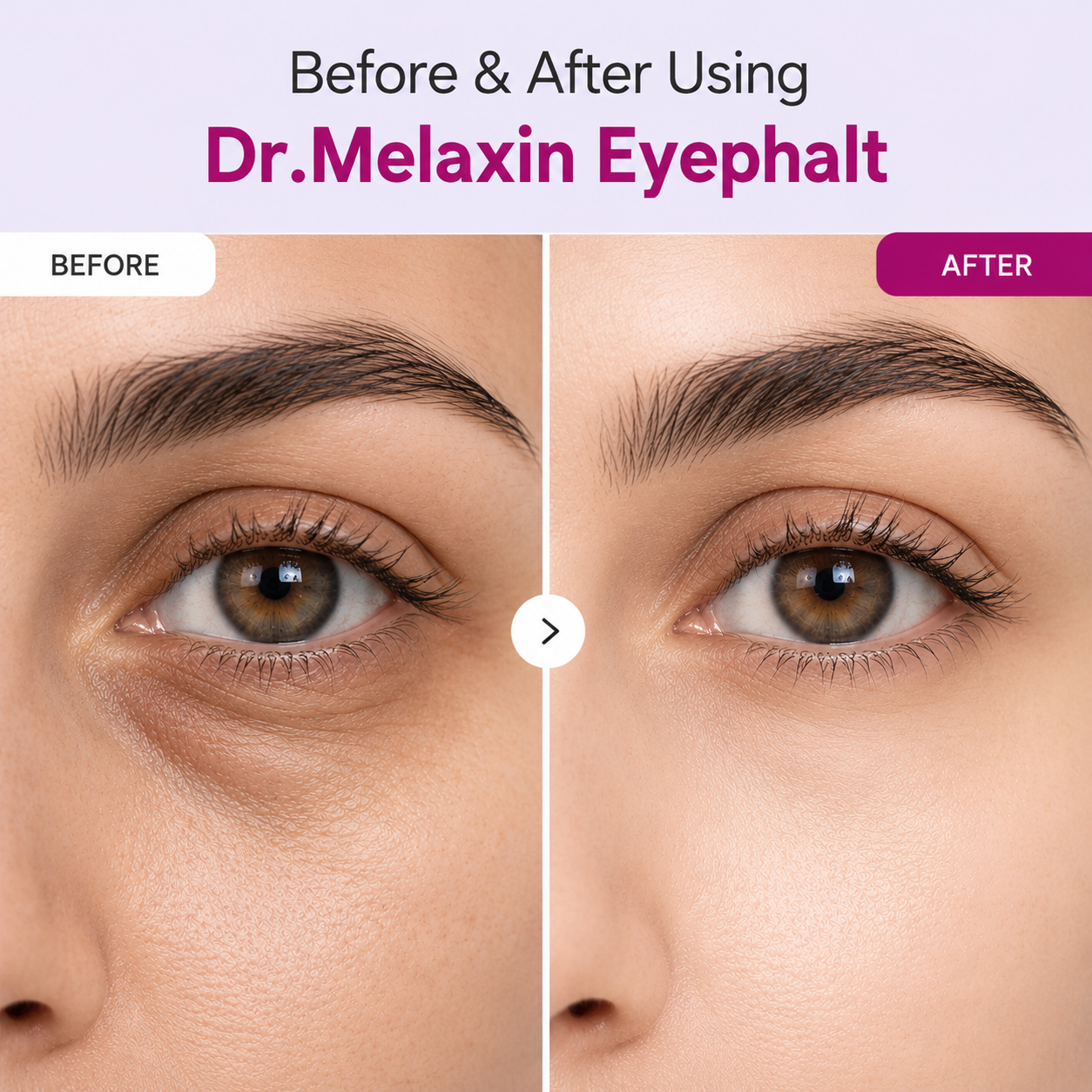 Dr Melaxin Eyephalt Eyecream