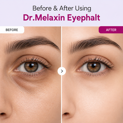 Dr Melaxin Eyephalt Eyecream