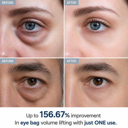 Dr Melaxin Eyephalt Eyecream